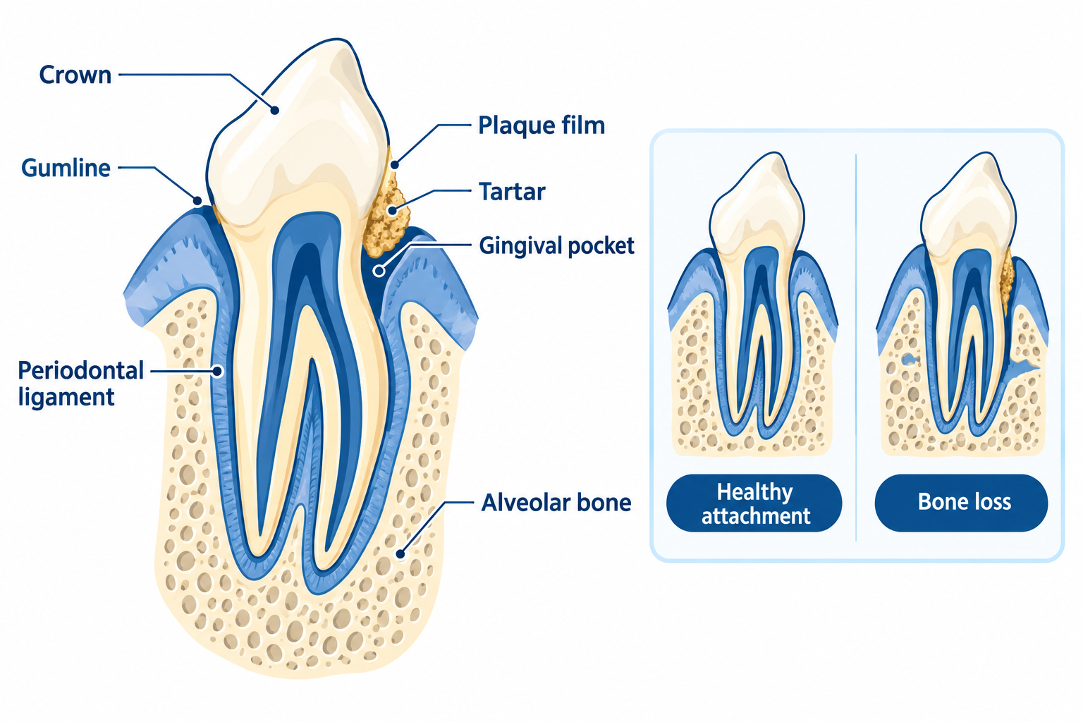 What Is Periodontal Disease in Dogs and How Does It Start?